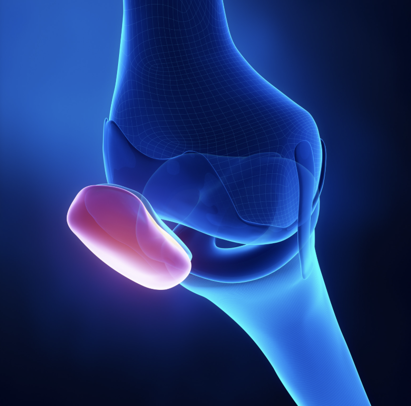 3D rendering of the knee showing the patella highlighted as it tracks over the trochlear groove.