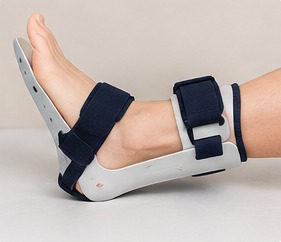 A night splint fitted to a foot and lower leg to hold the ankle in a neutral position.
