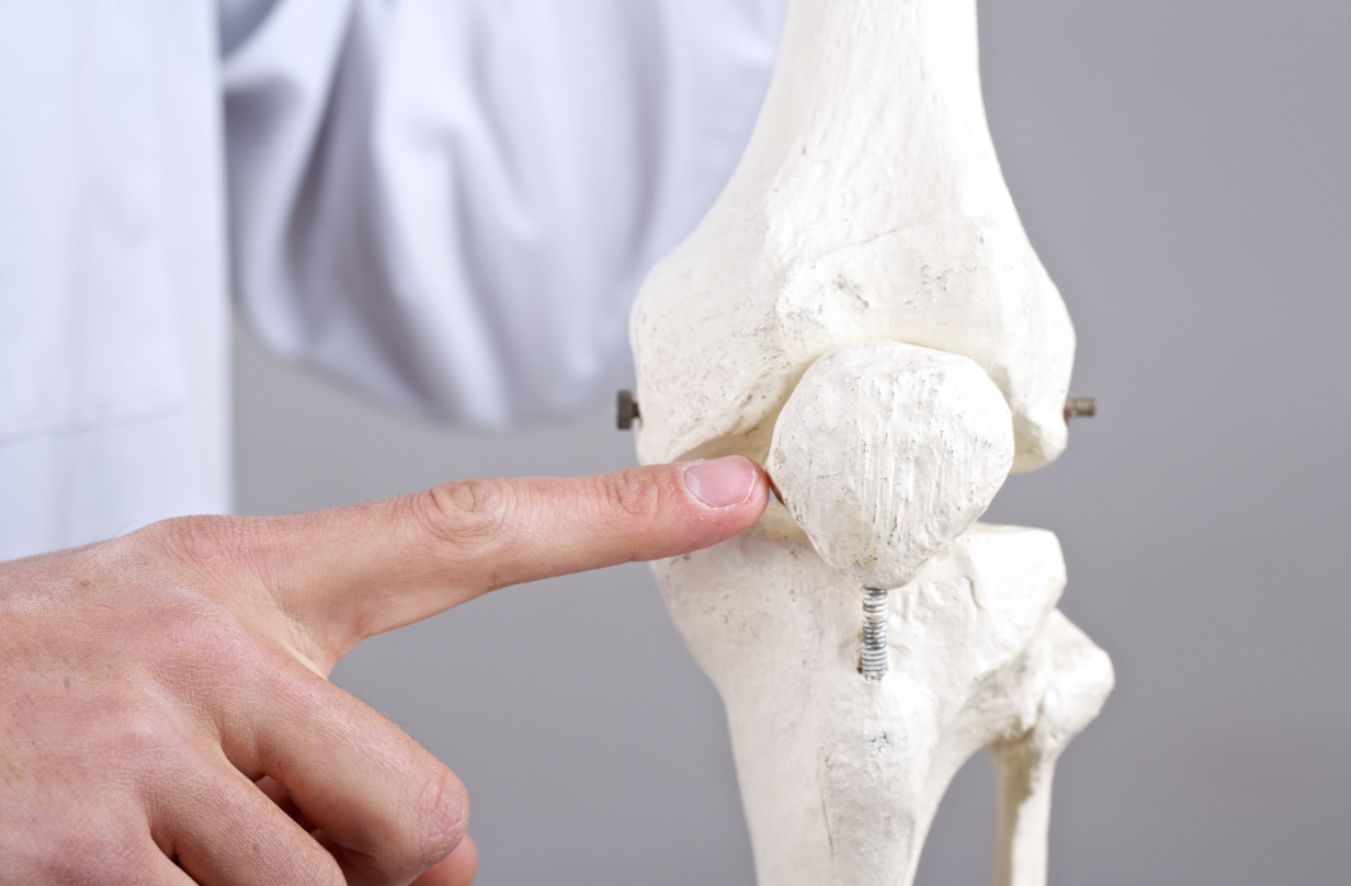 Clinician pointing to the kneecap on a skeletal model of the knee.